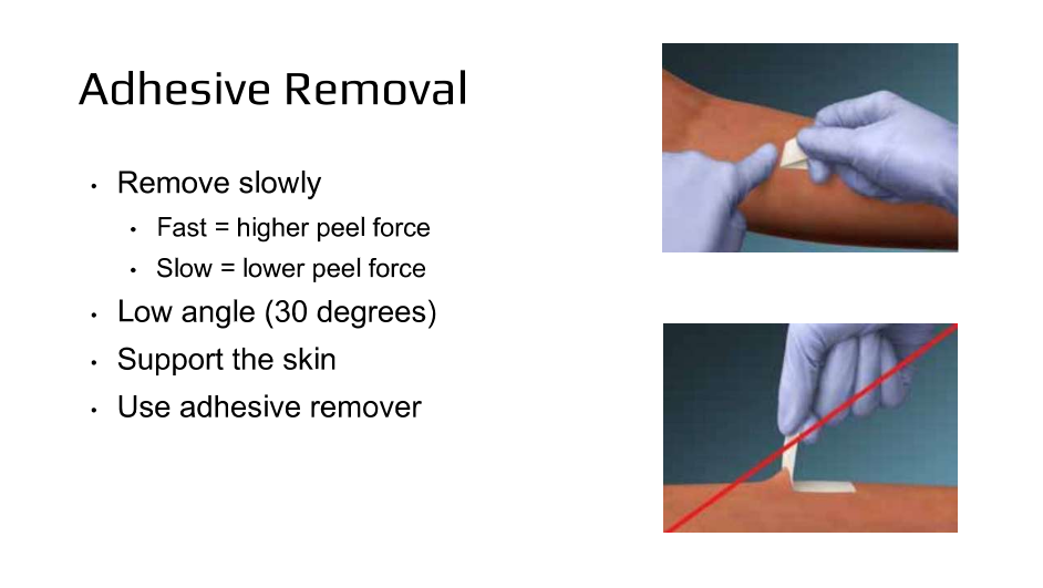 Slide 14